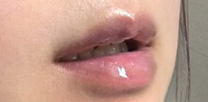 ティンティッドユースフルリップ